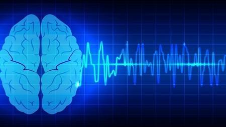 فناوری های کنترل کارکرد مغز توسعه می یابند تا بیماران عصبی و حرکتی درمان شوند